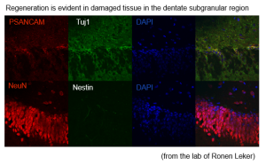 Hadassah BrainLabs | Global Ischemia