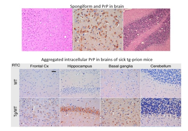 Hadassah BrainLabs | Prion (PrP) Pathology